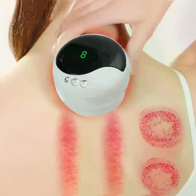 Антицеллюлитный вакуумный массажер Intelligent Cupping Massage, аккумуляторный ручной массажер для всего тела Белый LY-873-White Delimano 2054090 мультиколор 2054090 - изображение 5