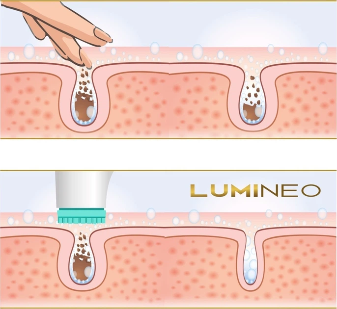 Szczoteczka do twarzy Lumineo Brush Pro 4 końcówki + żel do skóry wrażliwej turkusowa (5904726872772) - obraz 9