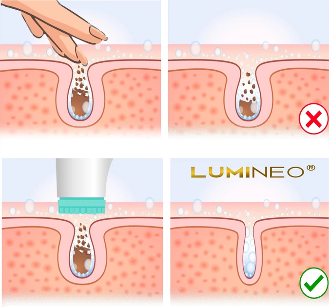Szczoteczka do twarzy Lumineo Brush Classic 3 końcówki + żel do skóry problematycznej (5904726872444) - obraz 8