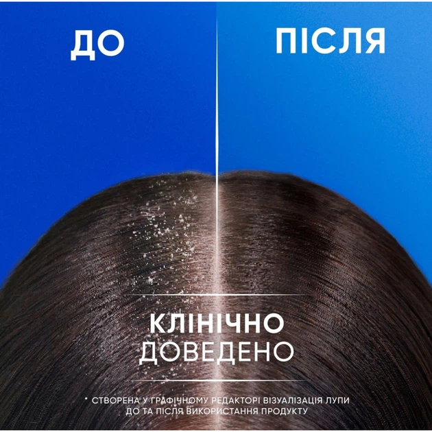 Шампунь Head & Shoulders 2 в 1 Против перхоти Яблочная свежесть 330 мл (8700216304689) - изображение 6