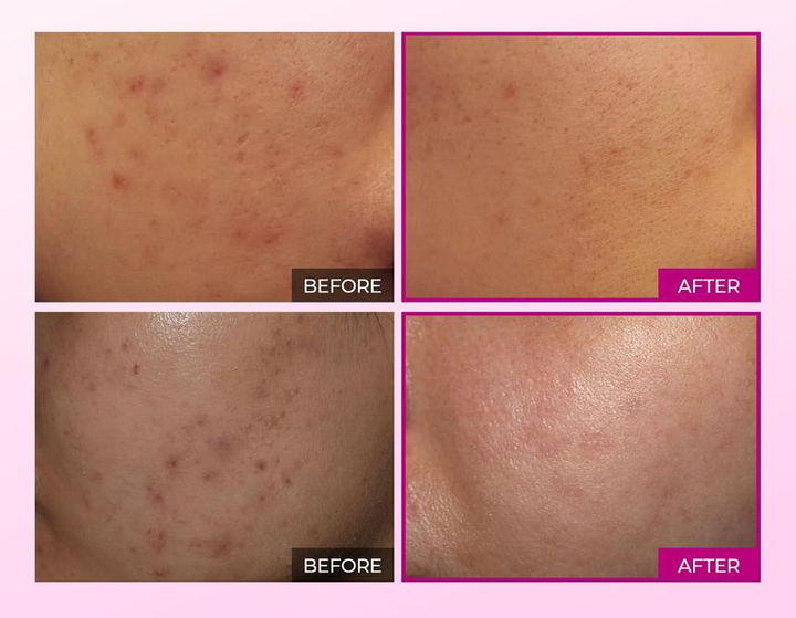 Сироватка для обличчя Dr.Melaxin Cemenrete Picotonic Shot Pigmentation Ampoule проти пігментних плям 30 мл (8809886481987) - зображення 5