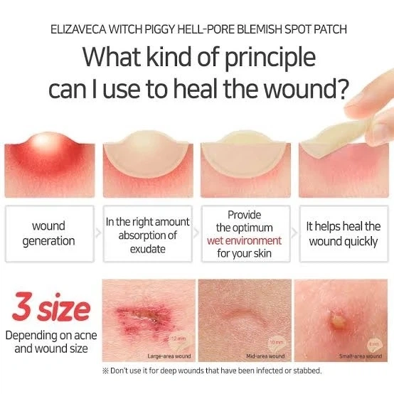 Пластыри-патчи для лечения воспалений Elizavecca Blemish Spot Patch 44 шт - изображение 4