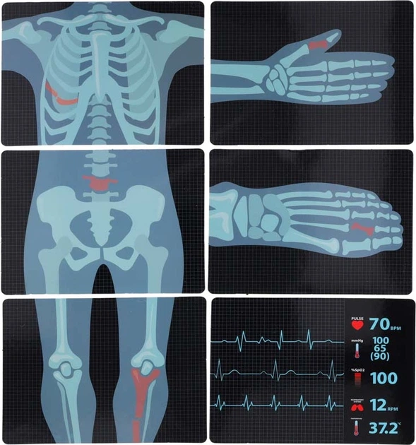 Zestaw lekarza KIK Mały doktor Stacja medyczna z EKG i RTG KX2948 (5903039768987) - obraz 12