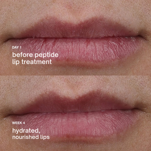 Бальзам для губ с пептидами Арбуз Rhode Peptide Lip Treatment Watermelon Slice 10 мл - изображение 4