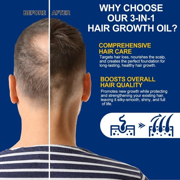 Масло для роста и укрепления волос Hair Growth Oil 3-in-1 Castor Oil + Biotin + Minoxidil 5% Sefudun , 60 ml - изображение 12