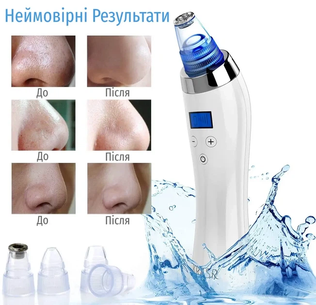 Вакуумный очиститель пор KRASR Comedo Suction, аппарат для микродермабразии и удаления черных точек (5 уровней) - Фото 5 Вакуумный очиститель пор KRASR Comedo Suction, аппарат для микродермабразии и удаления черных точек (5 уровней) - изображение 5