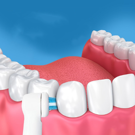 Насадка для електричної зубної щітки Oral-B Power Tip Care IP-17A для брекетів 4 шт - Фото 3 Насадка для електричної зубної щітки Oral-B Power Tip Care IP-17A для брекетів 4 шт - зображення 3