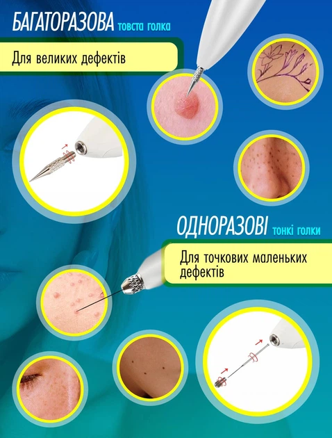 Электрокоагулятор плазменный косметологический прибор коагулятор для удаления родинок папиллом бородавок тату веснушек пигментных пятен элетро плазменная ручка Mini Freckle многофункциональный аппарат безболезненное коагулирование тканей - изображение 8