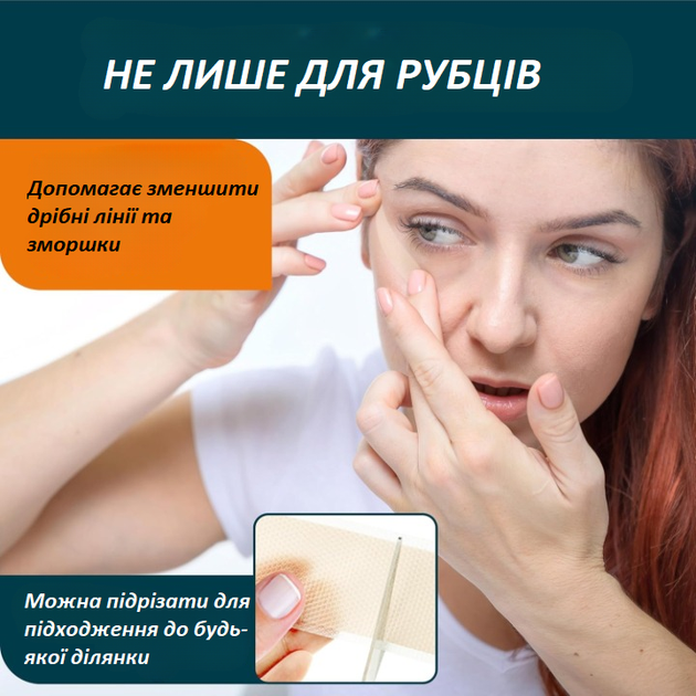 Набір для догляду за рубцями Nuvadermis Silicone Scar Tape & Overnight Intensive Scar Cream Duo (крем 40 мл і пластир 4 см × 300 см) - зображення 5