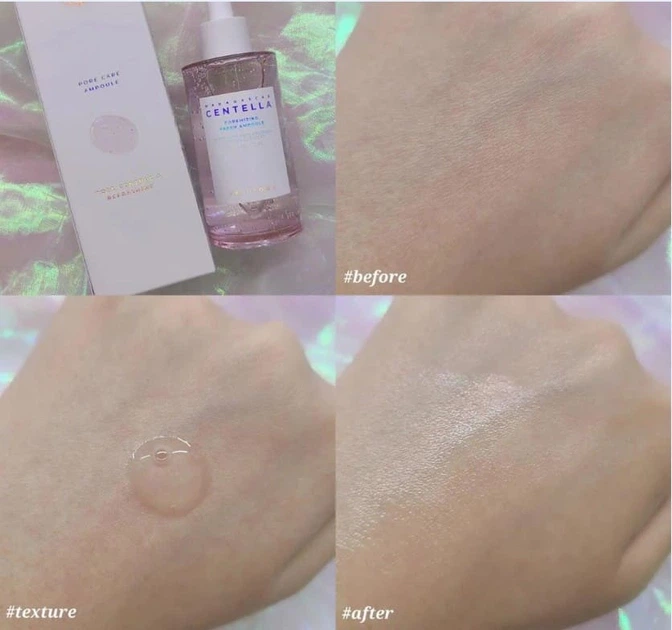 Сироватка для обличчя Skin 1004 Madagascar Centella Poremizing Fresh Ampoule, 100ml - Фото 4 Сироватка для обличчя Skin 1004 Madagascar Centella Poremizing Fresh Ampoule, 100ml - зображення 4