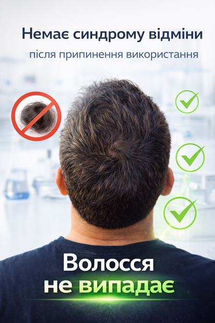 Сироватка для росту волосся та проти випадіння MAJOR з комплексом Redensyl який стимулює стовбурові клітини фулікули та ніацинамідом, 100 мл без синдрому відміни - Фото 7 Сироватка для росту волосся та проти випадіння MAJOR з комплексом Redensyl який стимулює стовбурові клітини фулікули та ніацинамідом, 100 мл без синдрому відміни - зображення 7