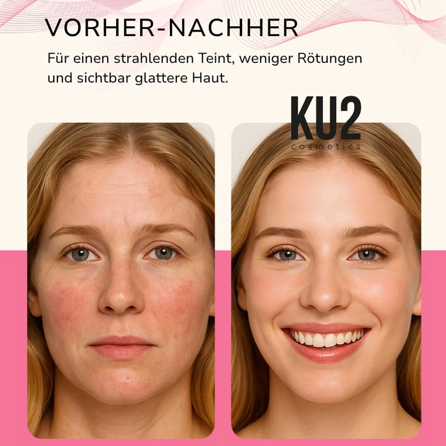 LED-маска для светотерапии лица KU2 Cosmetics (180 светодиодов) 7 режимов Black - Фото 6 LED-маска для светотерапии лица KU2 Cosmetics (180 светодиодов) 7 режимов Black - изображение 6