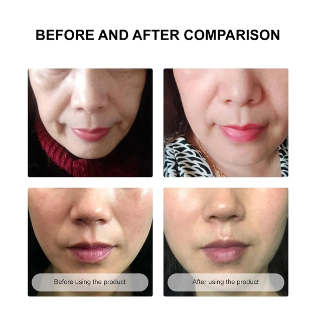Secret Strips Anti-Wrinkle Smile Line Patches пластирі від зморшок для обличчя та носогубних складок з сироваткою для ліфтингу та оновлення шкіри 10 шт. + 8 мл - Фото 3 Secret Strips Anti-Wrinkle Smile Line Patches пластирі від зморшок для обличчя та носогубних складок з сироваткою для ліфтингу та оновлення шкіри 10 шт. + 8 мл - зображення 3