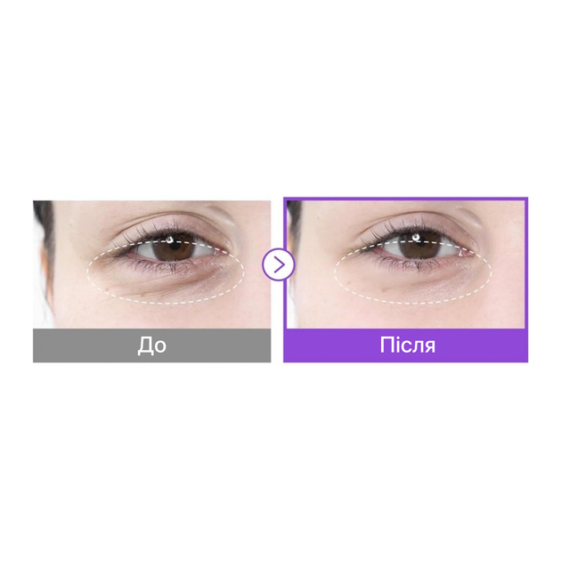Патчи для кожи вокруг глаз Numbuzin No.9 NAD+ Collagen Under Eye Patches, 1 пара - Фото 5 Патчи для кожи вокруг глаз Numbuzin No.9 NAD+ Collagen Under Eye Patches, 1 пара - изображение 5