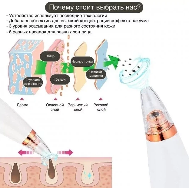 Апарат для глибокого вакуумного чищення пор обличчя Dermal Multi-Functional Cleaning - зображення 8