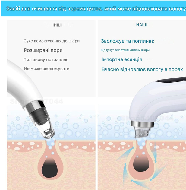 Вакуумный очиститель пор Hydrodermabrasion, аква пилинг, от черных точек - изображение 5