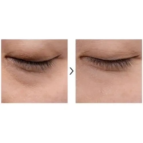Крем под глаза с бакучиолом и пептидами Tiam Vita A Bakuchiol Firming Eye Cream 30 мл - изображение 5