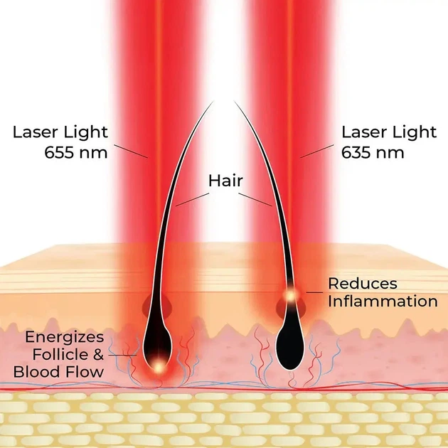 HAIRMAX Actonis™ Dual Action 18 лазерная расчёска для стимуляции роста волос (замена LaserComb Ultima 12) - изображение 5