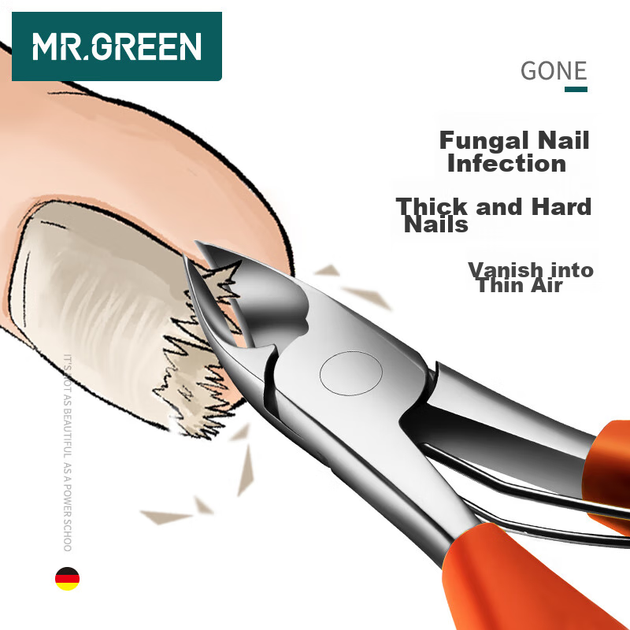 Кусачки MR.GREEN Mr-1026OR немецкие для вросших ногтей - изображение 4