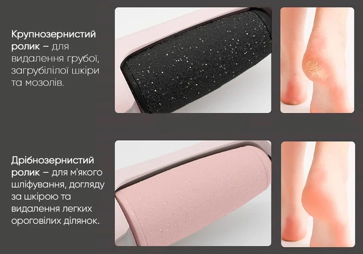 Электрическая пемза ProDobro ABS 90 г Розовая - изображение 2