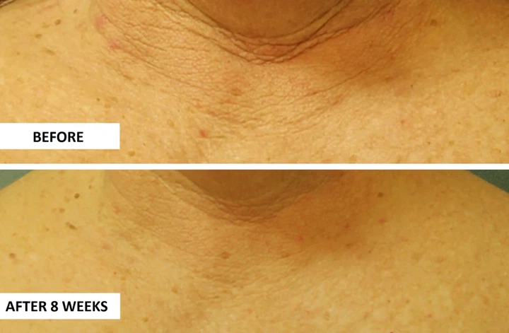Крем для лица Perricone MD Cold Plasma Plus+ Neck & Chest SPF 25rh 30 ml - Фото 2 Крем для лица Perricone MD Cold Plasma Plus+ Neck & Chest SPF 25rh 30 ml - изображение 2
