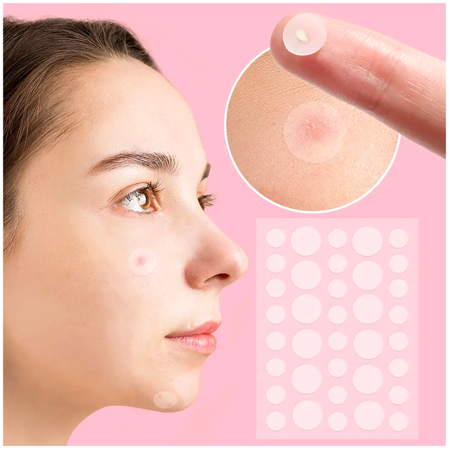 Патчи от прыщей и акне противовоспалительные 72 шт Acne Patch LS-1048 - Фото 5 Патчи от прыщей и акне противовоспалительные 72 шт Acne Patch LS-1048 - изображение 5