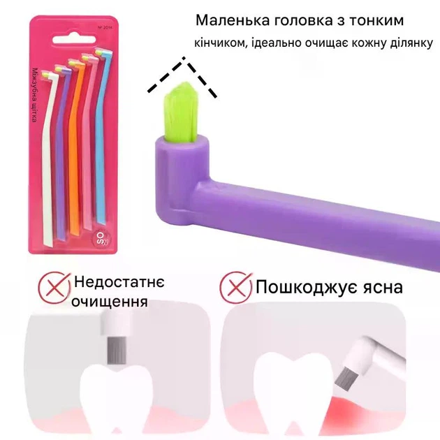 Монопучковая зубная щетка Interdental Brush, набор 5 шт для гигиены труднодоступных зон, брекетов - Фото 2 Монопучковая зубная щетка Interdental Brush, набор 5 шт для гигиены труднодоступных зон, брекетов - изображение 2