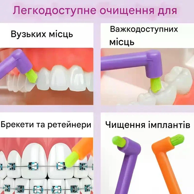 Монопучковая зубная щетка Interdental Brush, набор 5 шт для гигиены труднодоступных зон, брекетов - Фото 3 Монопучковая зубная щетка Interdental Brush, набор 5 шт для гигиены труднодоступных зон, брекетов - изображение 3