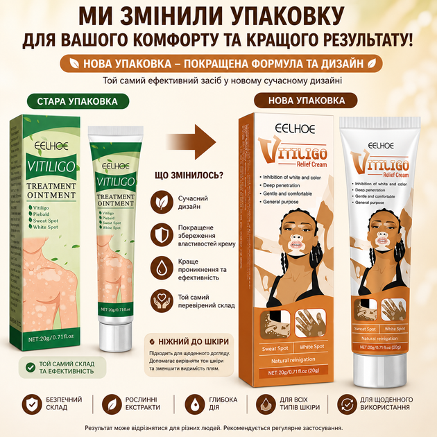 Крем от витилиго для восстановления пигмента кожи и уменьшения белых пятен 20 г EELHOE - Фото 2 Крем от витилиго для восстановления пигмента кожи и уменьшения белых пятен 20 г EELHOE - изображение 2