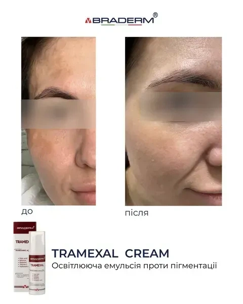 Освітлювальний крем BRADERM Tramexal Cream, 30 мл 00-00000388 - зображення 5