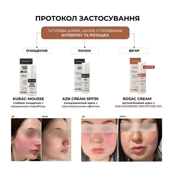 Успокаивающий крем BRADERM Rosac Cream, 30 мл 00-00000389 - изображение 2