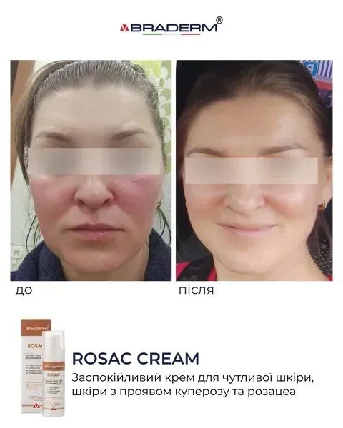 Успокаивающий крем BRADERM Rosac Cream, 30 мл 00-00000389 - изображение 5