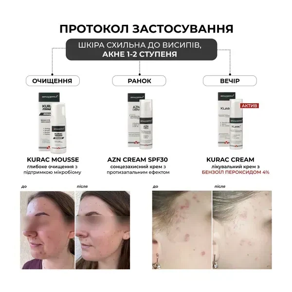 Противовоспалительный крем BRADERM Kurac Cream, 30 мл 00-00000386 - изображение 2