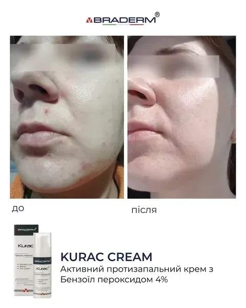 Противовоспалительный крем BRADERM Kurac Cream, 30 мл 00-00000386 - изображение 6