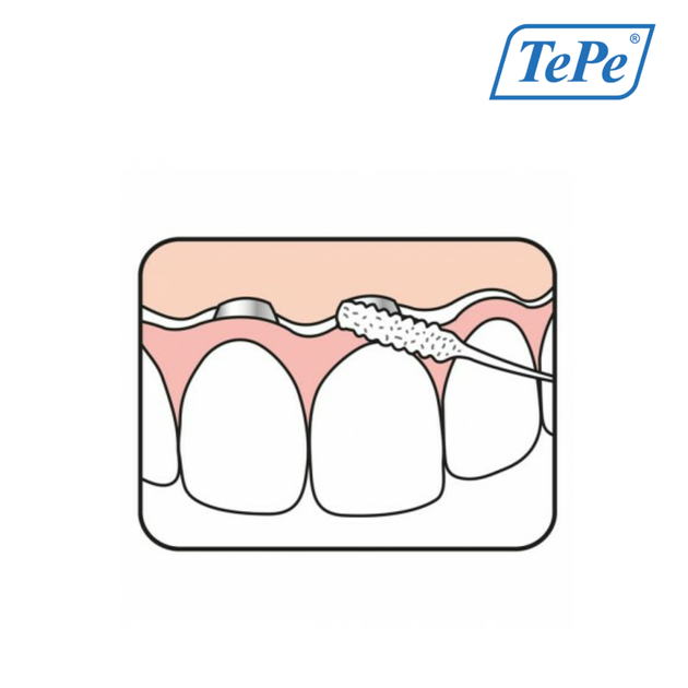 Зубная нить TePe Bridge & Implant для имплантатов, мостов и брекетов, 30 шт - изображение 6