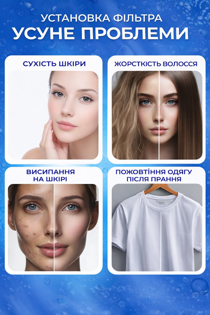 Фільтр для води проточний на душову лійку грубого очищення для ванної + 10 картриджів (FILTR-10) - изображение 4