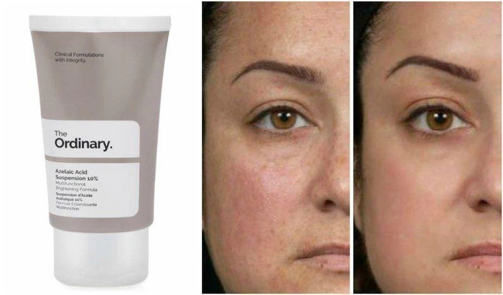 Суспензія з азелаїнової кислоти The Ordinary Azelaic Acid Suspension 10% 30 мл - Фото 2 Суспензія з азелаїнової кислоти The Ordinary Azelaic Acid Suspension 10% 30 мл - зображення 2