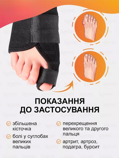 Вальгусные шины от косточки на большом пальце ног ортопедические корректор при вальгусной деформации стопы - изображение 3