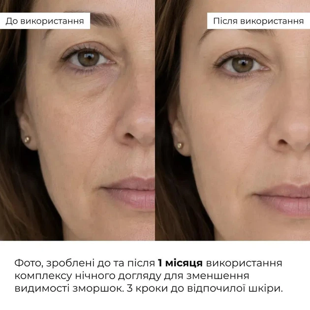 Комплекс ночного ухода для уменьшения видимости морщин Крем, Гель, Патчи HiLLARY K-11-553 - изображение 2