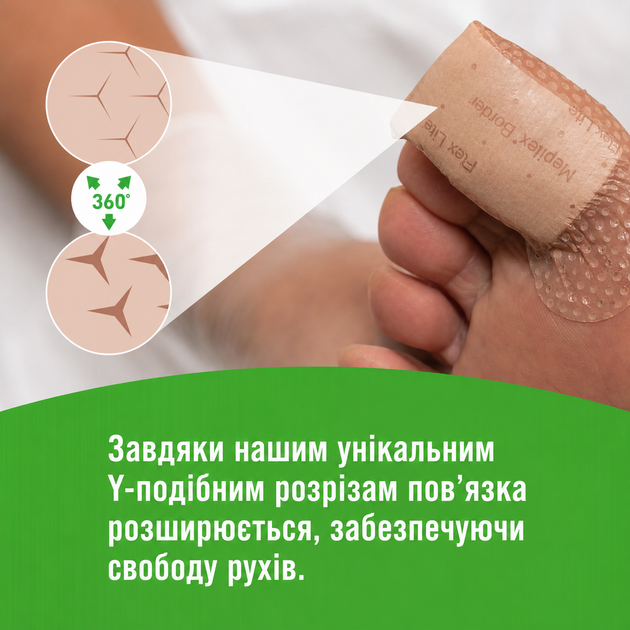 Медицинский водонипроницаемый пластырь Mepilex Border Flex 10 x 10 см для ран и травм кожи 10 шт - изображение 6