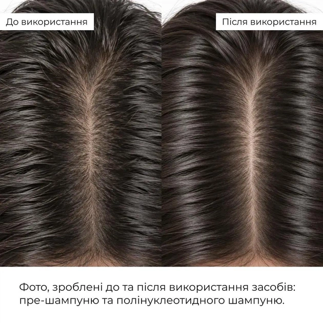 Комплекс для зменшення випадіння та глибокого очищення шкіри голови: Пілінг, Шампунь, Кондиціонер HiLLARY K-11-207 - Фото 7 Комплекс для зменшення випадіння та глибокого очищення шкіри голови: Пілінг, Шампунь, Кондиціонер HiLLARY K-11-207 - зображення 7