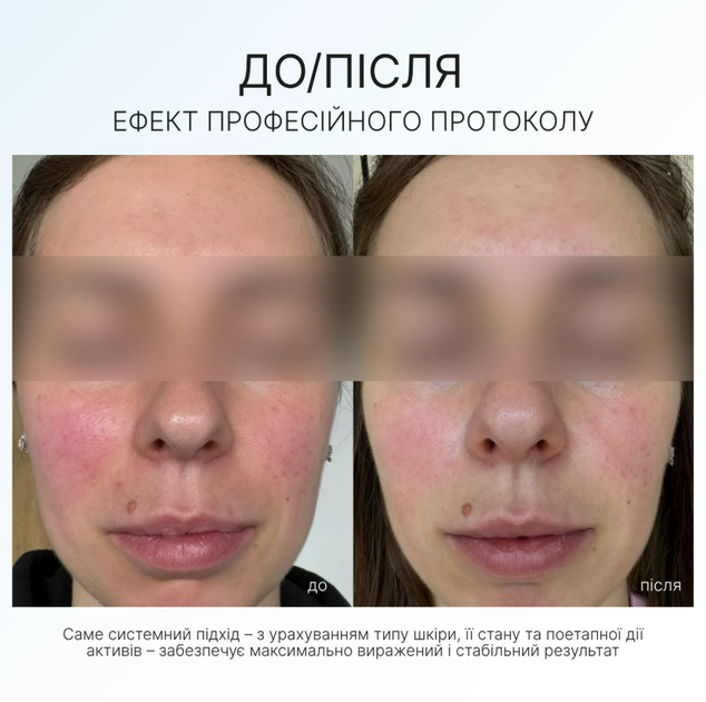 AG Skin Зволожуючий крем SPF 50+ MOISTURISING CREAM SPF 50+ - зображення 2