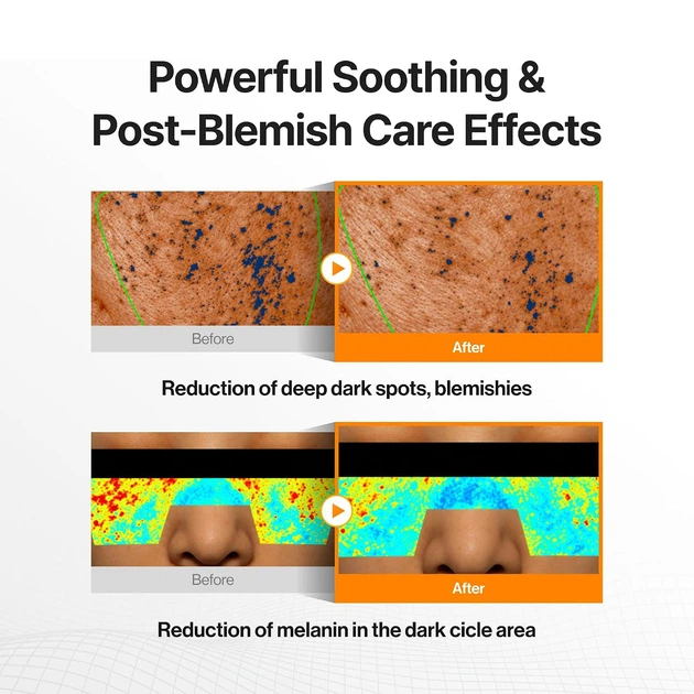 Крем Celimax Pore+Dark Spot Brightening Cream 35 мл Осветляющий для лица Селимакс с 5% ниацинамидом и 5% транексамовой кислотой от пигментных пятен, для выравнивания тона кожи - изображение 6
