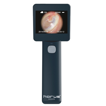 Отоскоп цифровий MIIS EOC100 Horus Digital Otoscope Full HD для діагностики слухового каналу (mpm_00255)