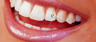 Стрази на зуби Skyce 1.5 мм 1шт