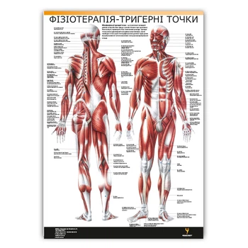 Плакат "Фізіотерапія-тригерні точки" Медіспорт TM 150