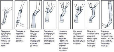 Компресійні гольфи Ortolife відкритий носок 2 клас 23-32 мм р.с. Розмір L Бежеві (OL-106)