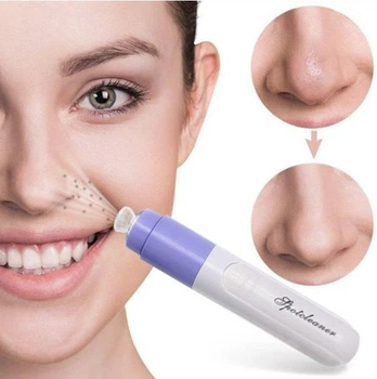 Вакуумный очиститель пор лица Elite Pore Cleaner EL-1163 на батарейках