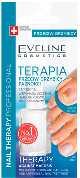 Терапія проти грибка нігтів Eveline Cosmetics Nail Therapy Professional 12 мл (5901761956610)