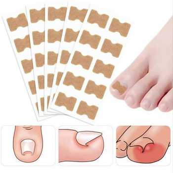 Пластир для корекції врослого нігтя Toenail Correction Sticker 20 шт